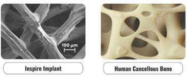 Structure Designed to Mimic the Morphology of Cancellous Bone. Courtesy of Curiteva.com