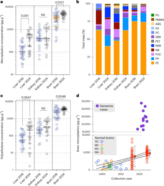 Microplastic concentrations in liver, kidney and brain decedent human samples. Courtesy of Bioaccumulation of microplastics in decedent human brains.